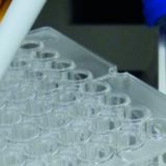 Antibiotic-resistant pathogens in household appliances (press release)